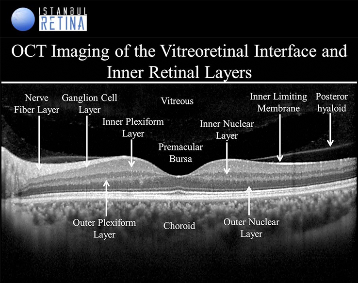 Optical Coherence Tomography_OCT Scans The Monocle1
