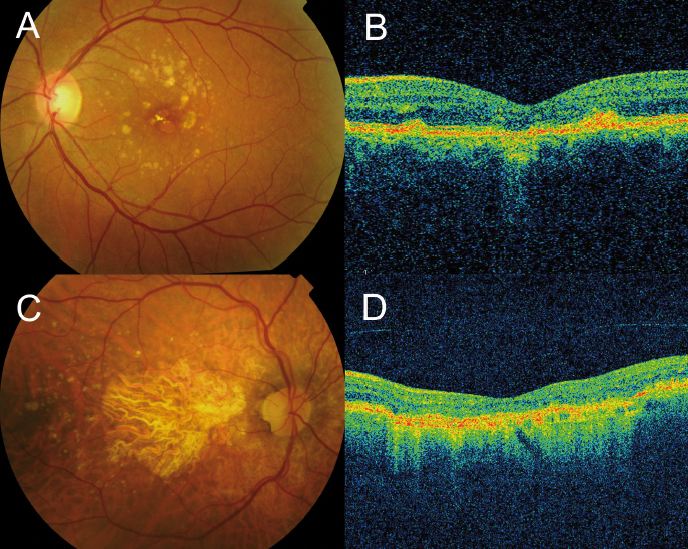 Optical Coherence Tomography_OCT Scans The Monocle3