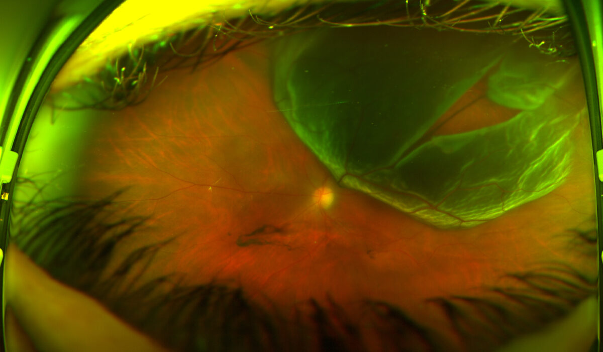 RD optosOptos Retinal Imaging