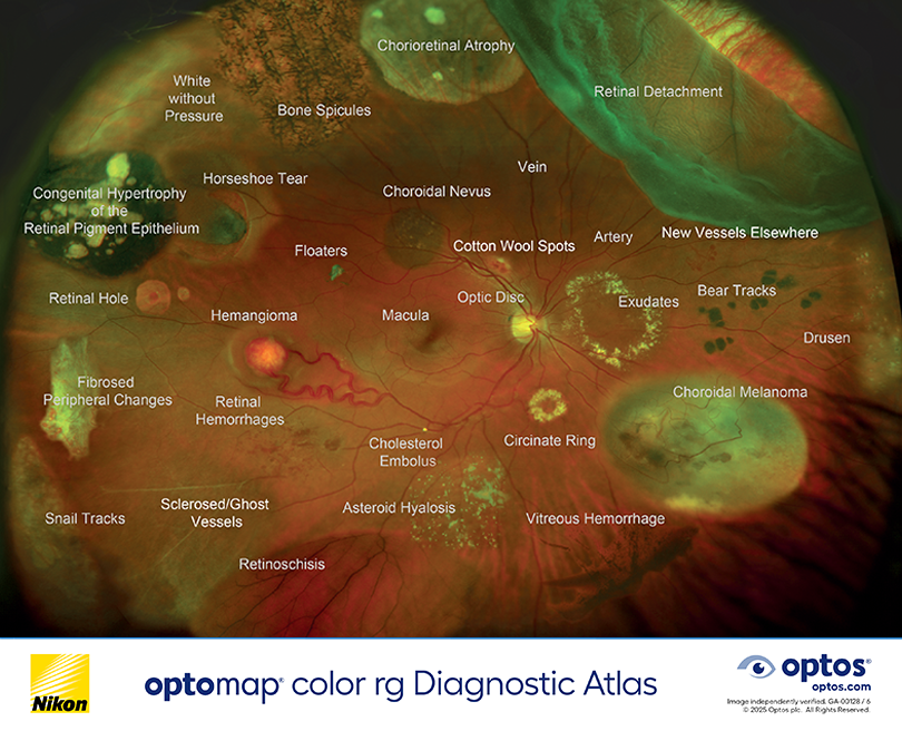 atlas-color-rg-us_410x328pxOptos Retinal Imaging
