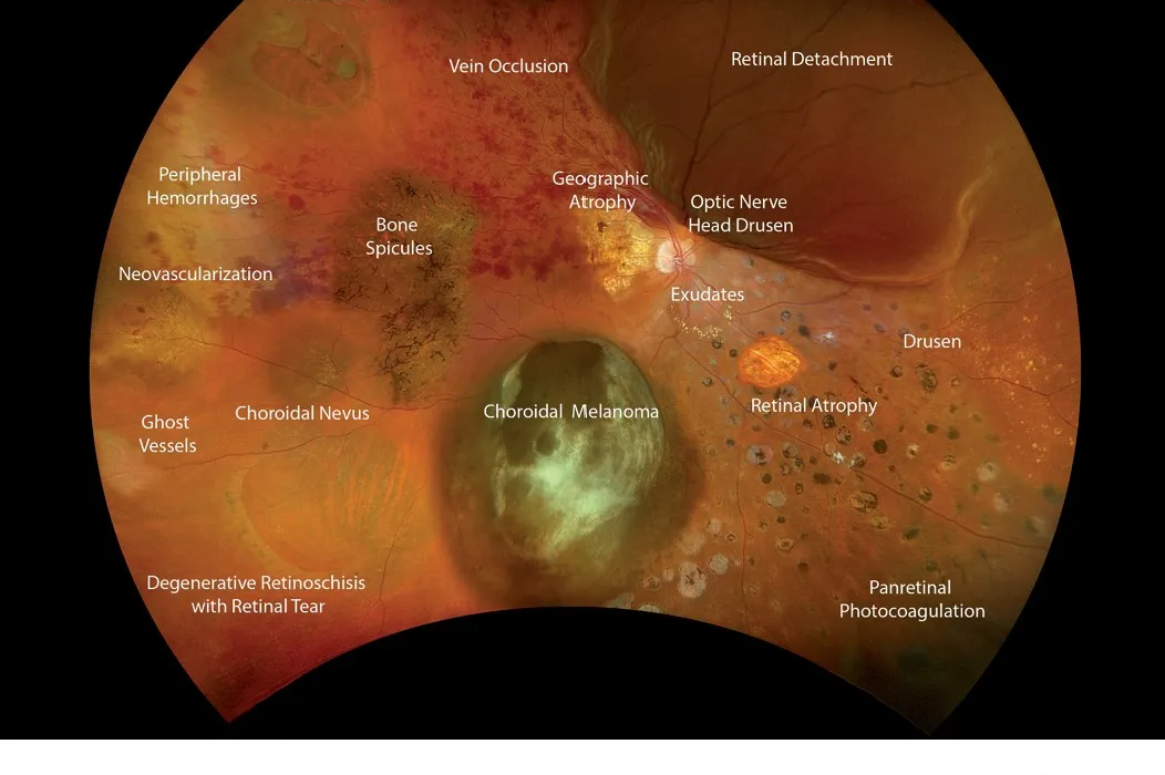 booklet-atlas-core-modalities-usOptos Retinal Imaging